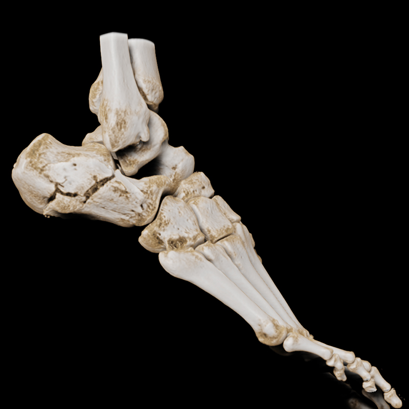 Global Illumination Foot